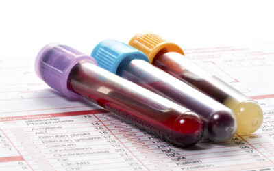 Sensibilité à l’insuline : les 3 marqueurs sanguins à surveiller